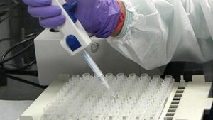 Supreme Court to look into feasibility of NAT for blood transfusion